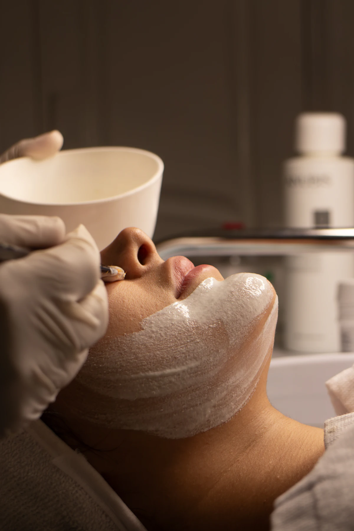 Acne Clearing Peel aesthetic procedure at AMK Aesthetics