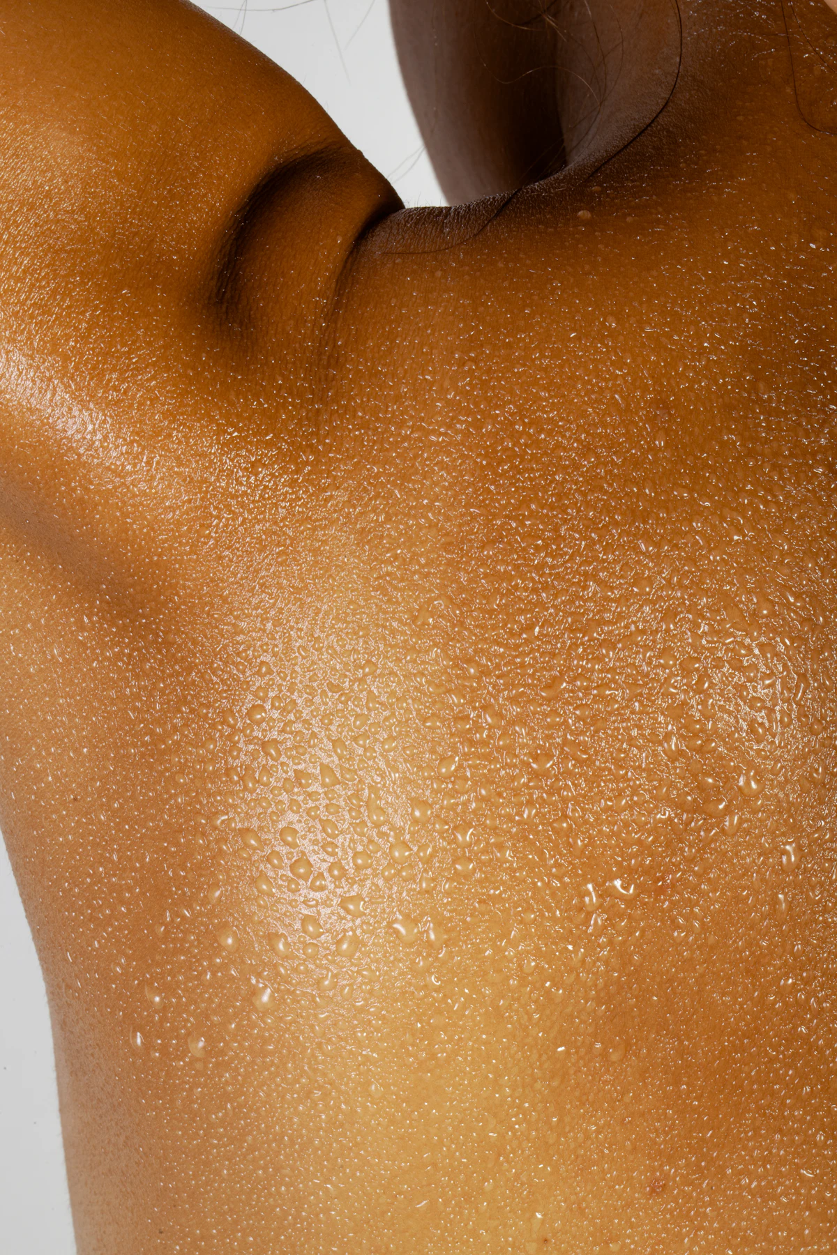 Excessive Sweating Treatment aesthetic procedure at AMK Aesthetics
