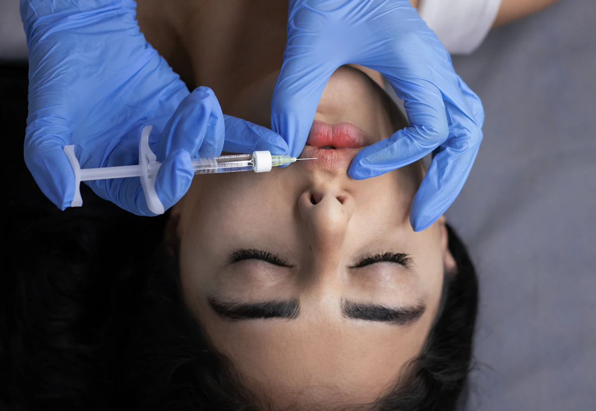 Lip Fillers aesthetic procedure at AMK Aesthetics