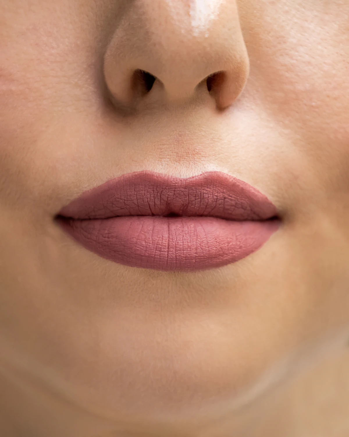 Lip Flip aesthetic procedure at AMK Aesthetics