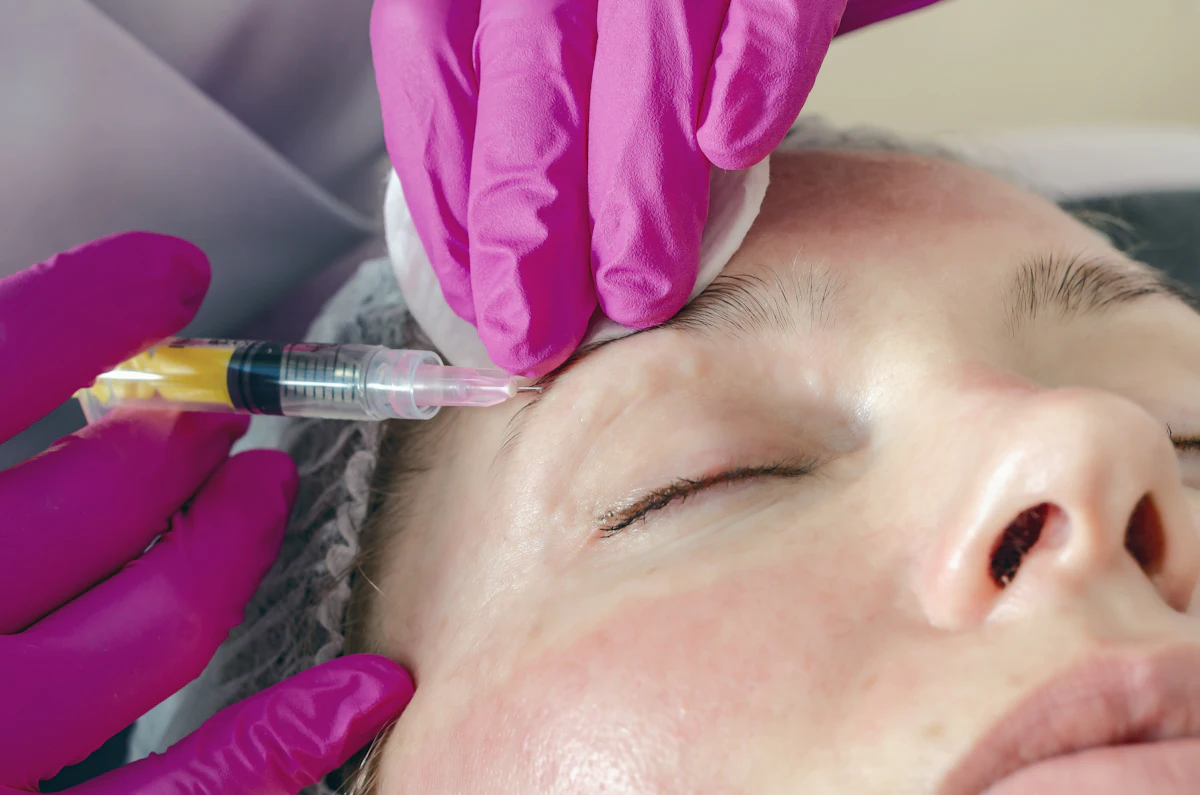 Micro-Botox aesthetic procedure at AMK Aesthetics