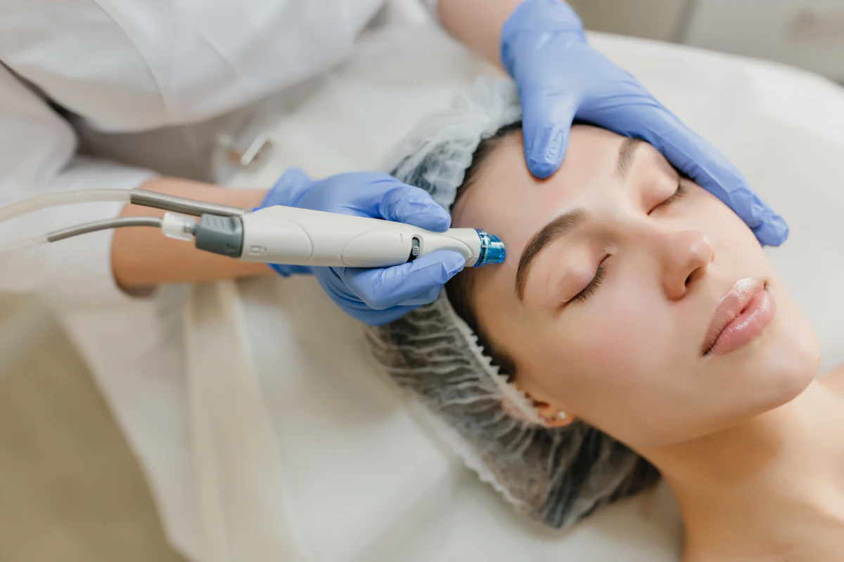 Microneedling aesthetic procedure at AMK Aesthetics