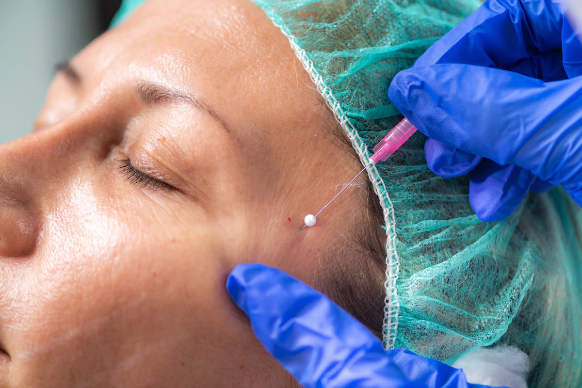 Non-Surgical Facelift aesthetic procedure at AMK Aesthetics