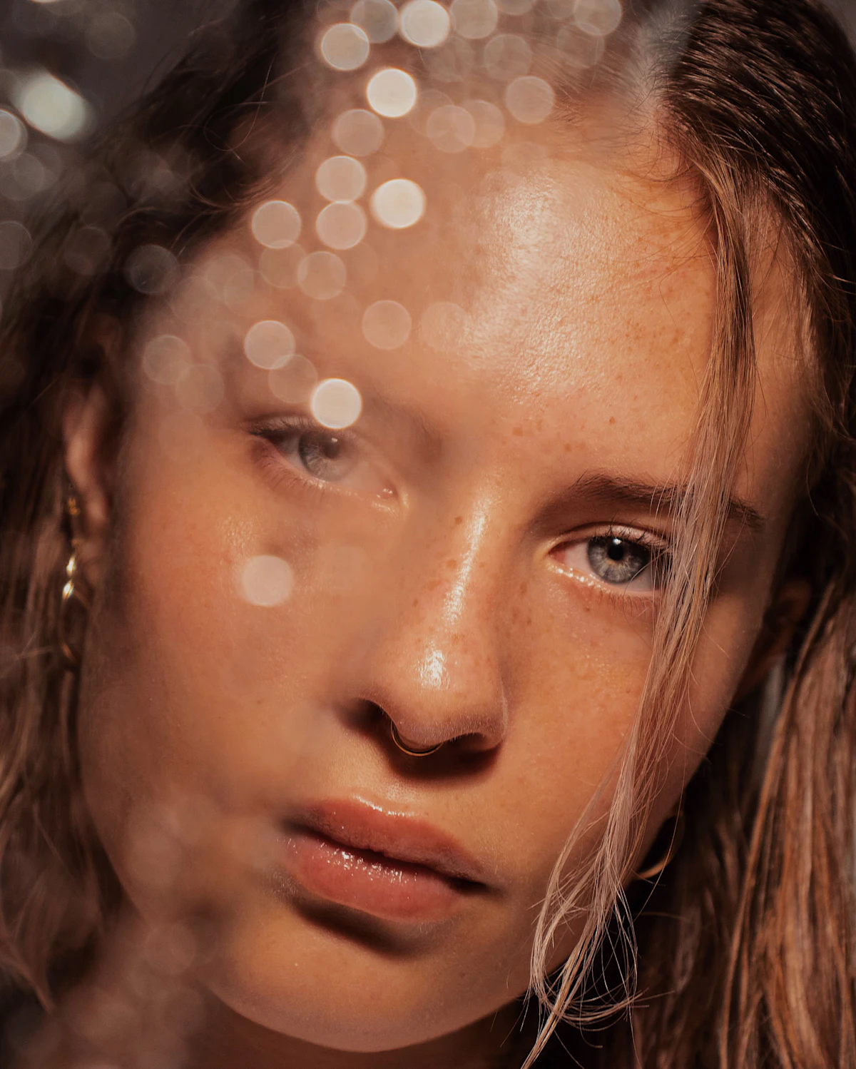 Pigmentation Treatment aesthetic procedure at AMK Aesthetics