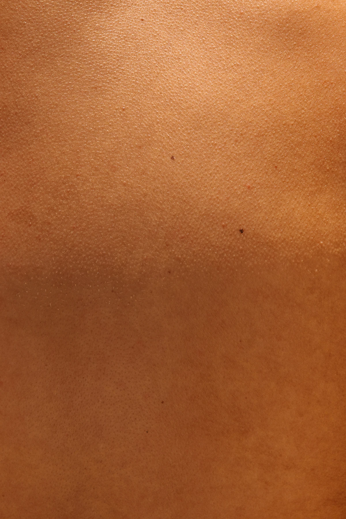 Skin Tag Removal aesthetic procedure at AMK Aesthetics