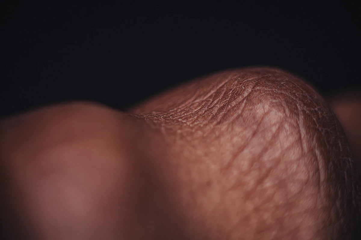 Hives & Skin Allergy Treatment aesthetic procedure at AMK Aesthetics